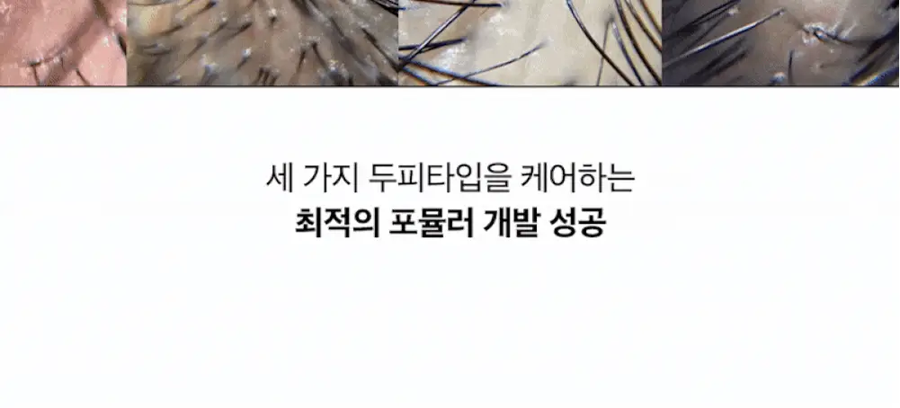 [탈모증상개선] 리필드 사이토카인 부스터 프로 70ml 단품/기획 2종 택1 상세페이지 10